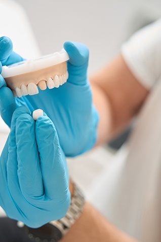 Dentist in blue gloves holding sample dental crown and model teeth