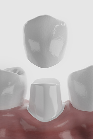 Rendering of shiny dental crown over shiny teeth and gums