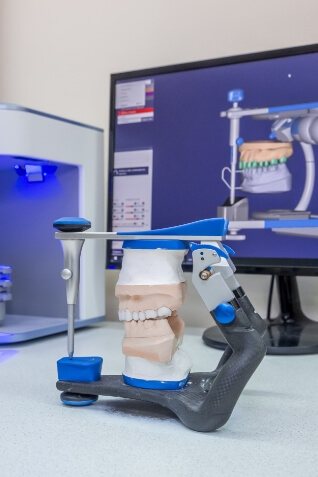 Model of teeth in front of computer screen showing digital model of teeth