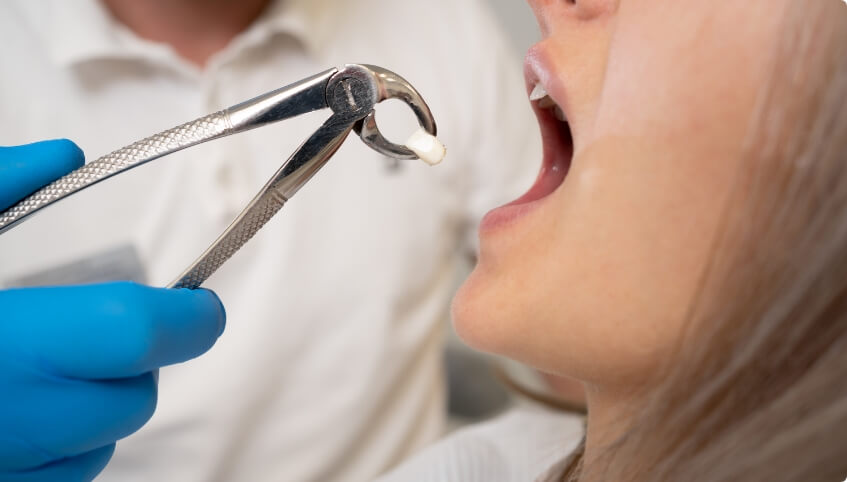Woman getting a tooth extraction in Yarmouth